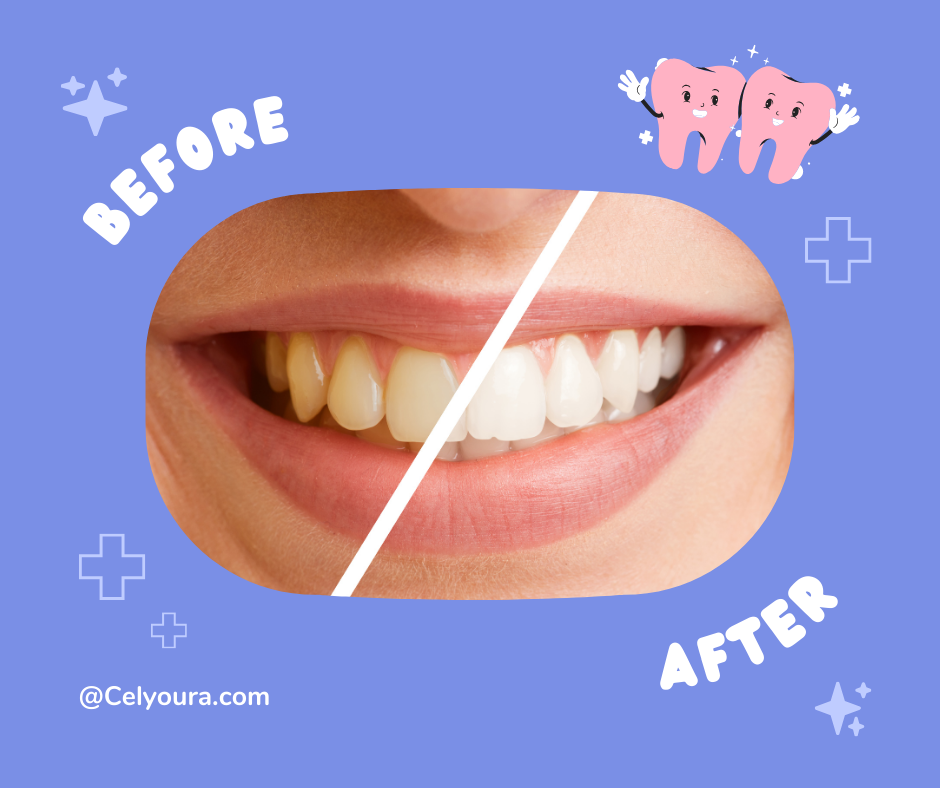 Purple Teeth Cleaning Powder