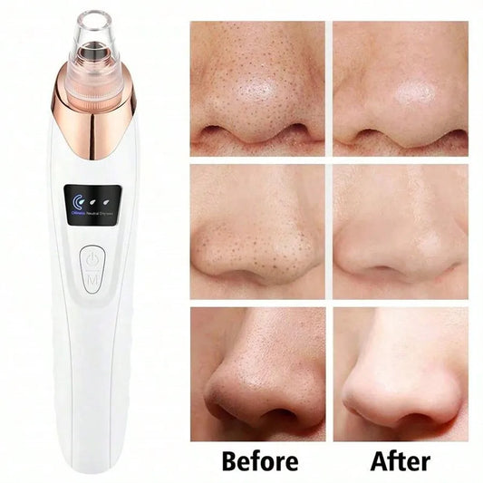 Facial cleansing and blackhead removal machine